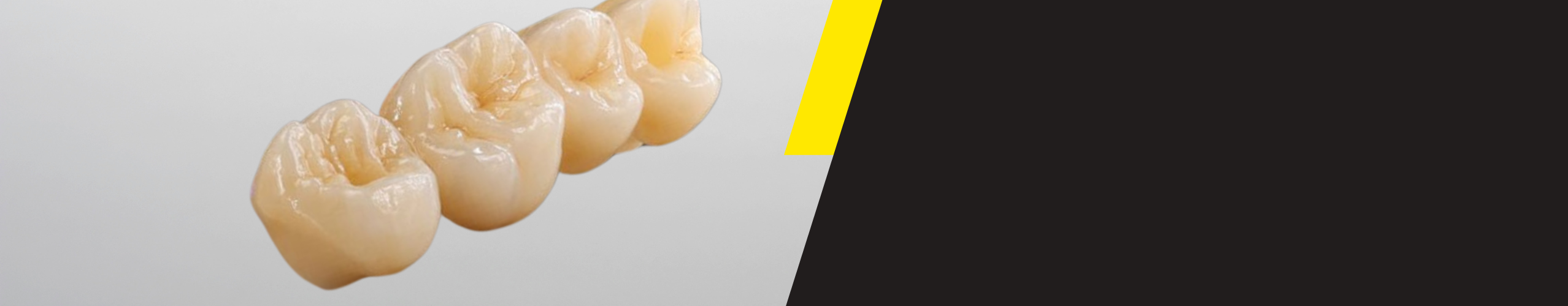 Zirconia - slider - alternativ.png